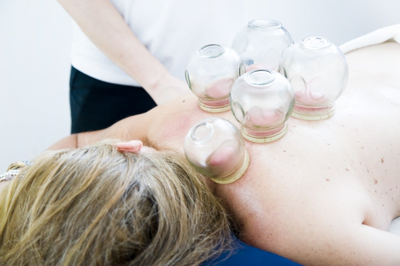 Vuurcupping massage bij Massagesalon Miranda